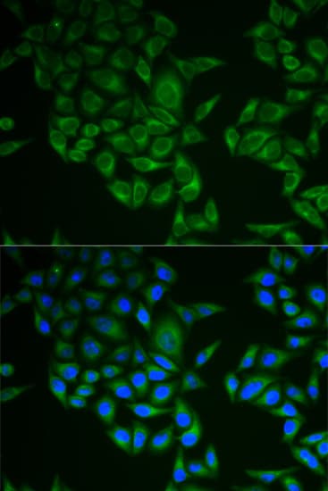 Polyclonal Rabbit anti-Human CD247 / CD3 Zeta Antibody (IHC, IF, WB)