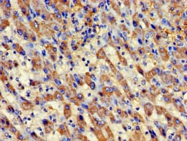 Polyclonal Rabbit anti-Human AURKC / Aurora C Antibody (IHC, IF, WB)