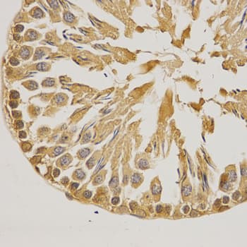 SUMO1 / SMT3 Antibody