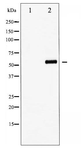 FOXO4 / AFX1 Antibody (phospho-Thr451)