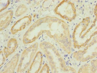 NAR / CPSF4 Antibody