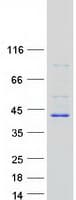 Human BLVRA Protein (Recombinant Myc-DDK (Flag))