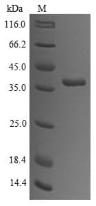 Rabbit TPM1 / Tropomyosin Protein (Recombinant 6His, N-terminus + Myc, C-terminus)