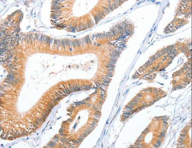 ACY3 Antibody