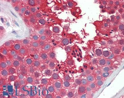 IHC-plus™ LDHC / Lactate Dehydrogenase C Antibody