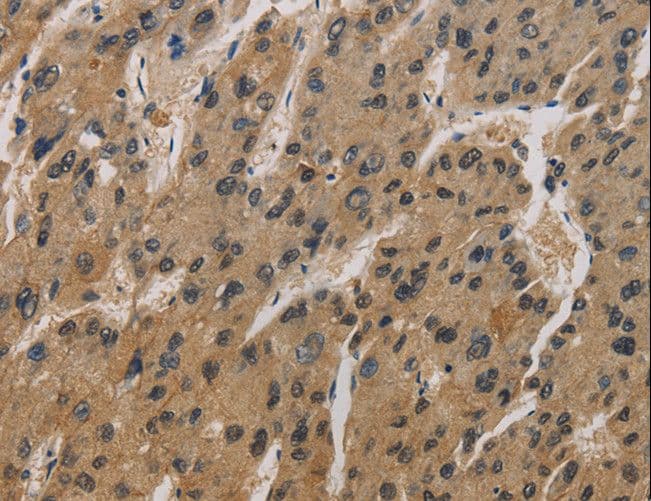 Polyclonal Rabbit anti-Human CORO1C Antibody (IHC, WB)