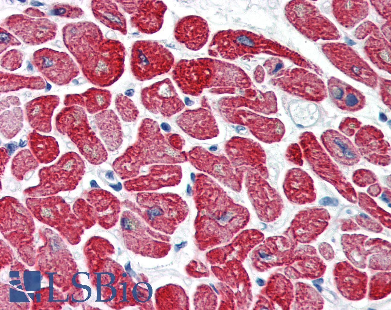 IHC-plus™ Tropomyosin Antibody