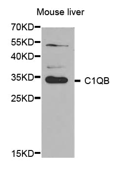 Polyclonal Rabbit anti-Human Complement C1QB Antibody (IHC, WB)