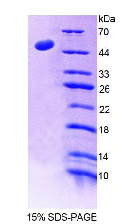 Human LAD1 Protein (Recombinant His-GST)