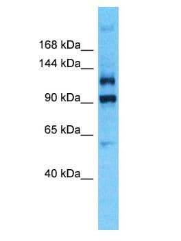 PLEKHG4B Antibody (aa1021-1070)