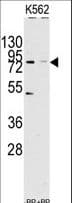 JHDM1A / KDM2A Antibody (aa867-896)