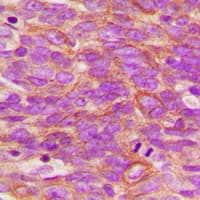Polyclonal Rabbit anti-Human NTRK1 / TrkA Antibody (phospho-Tyr496, IHC, IF, WB)