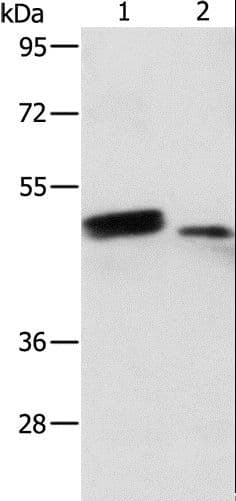Polyclonal Rabbit anti-Human RARB / RAR Beta Antibody (WB)