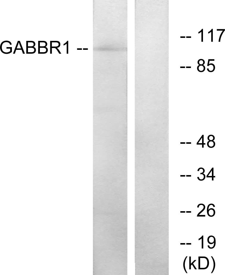Polyclonal Rabbit anti-Human GABBR1 / GABA B Receptor 1 Antibody (aa891-940, IF, WB)