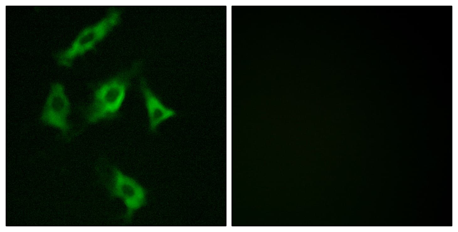 PathPlus™ Polyclonal Rabbit anti-Human STMN1 / Stathmin / LAG Antibody (aa5-54, IHC, IF, WB)
