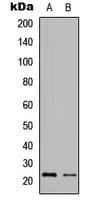 Polyclonal Rabbit anti-Human GZMH / Granzyme H Antibody (Internal, IHC, IF, WB)