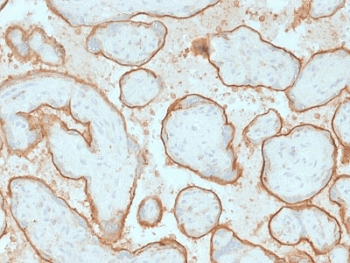 EGFR Antibody (clone GFR/2341)