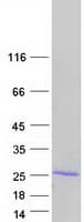 Human TNFAIP8 / SCC-S2 Protein (Recombinant Myc-DDK (Flag))