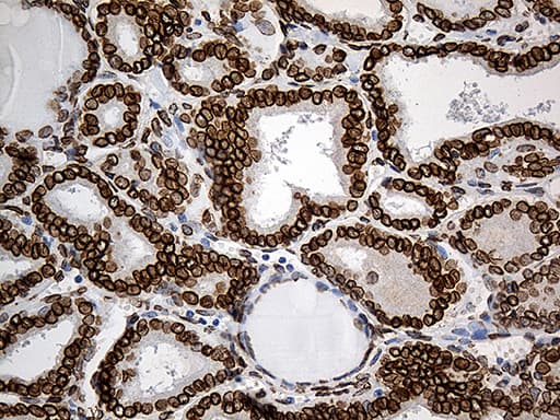 SLU7 / 9G8 Antibody (aa1-300, clone OTI6B1)