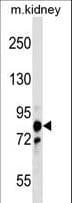 Polyclonal Rabbit anti-Human PNPT1 Antibody (aa284-311, WB)