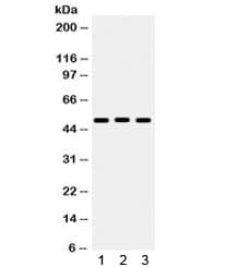 BMP5 Antibody