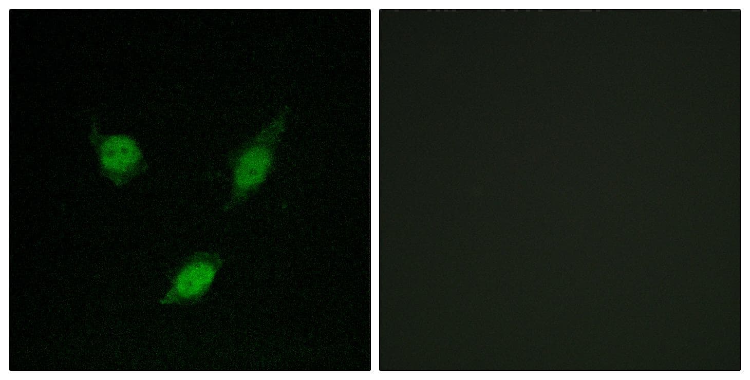 Polyclonal Rabbit anti-Human TACC1 Antibody (IF, WB)