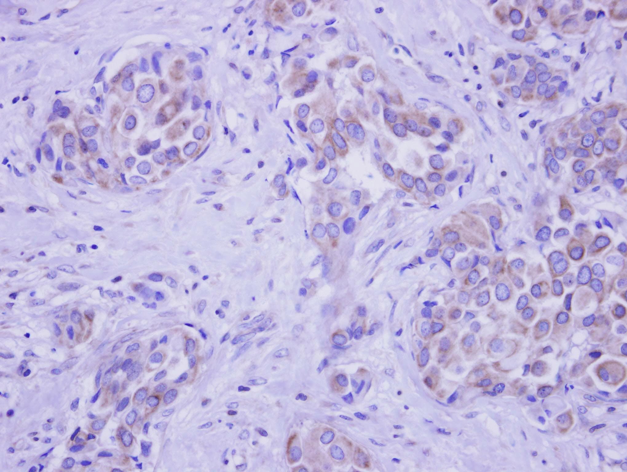 GALNT2 Antibody