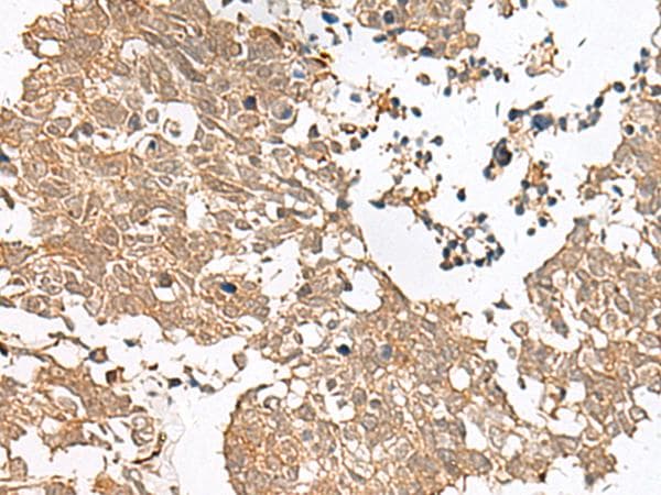 GRASP Antibody