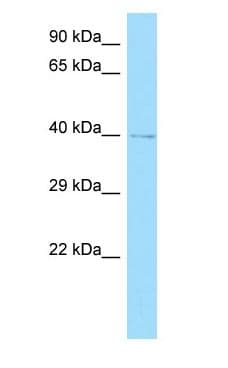Polyclonal Rabbit anti-Human GRINA Antibody (aa147-196, WB)