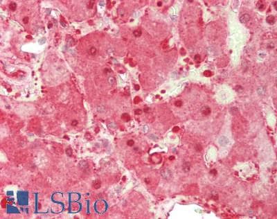 IHC-plus™ RAB7A / RAB7 Antibody