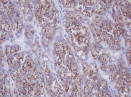 IF3mt / MTIF3 Antibody (clone OTI4G2)