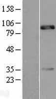 Human CDH18 / Ey-Cadherin Protein (Over-Expression Lysate Myc-DDK (Flag))