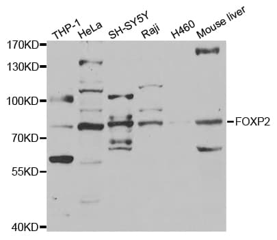 Polyclonal Rabbit anti-Human FOXP2 Antibody (IHC, WB)
