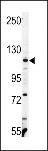 VCL / Vinculin Antibody (aa1012-1039)