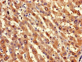 LPGAT1 Antibody