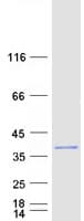 Human PPM1L Protein (Recombinant Myc-DDK (Flag))