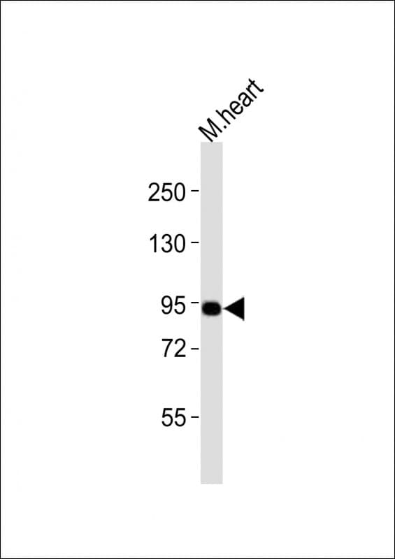 UHRF1 Antibody (aa596-628)