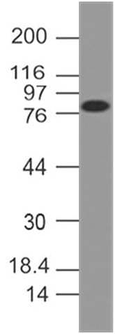 FSH Receptor / FSHR Antibody