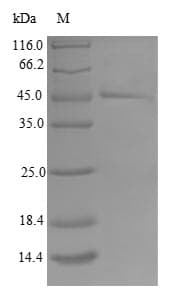 Human TIMM17B Protein (Recombinant GST, N-terminus)
