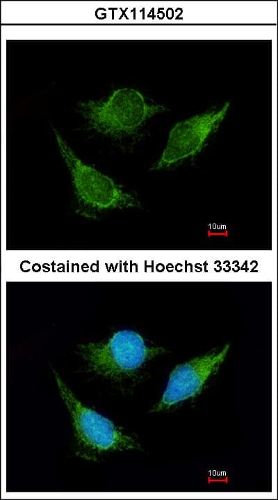 Polyclonal Rabbit anti-Human IVD Antibody (aa1-222, IHC, WB)