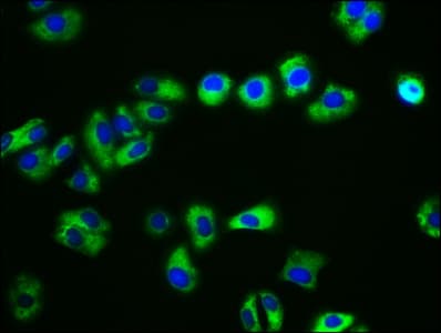 Polyclonal Rabbit anti-Human CDH15 / M Cadherin Antibody (WB)