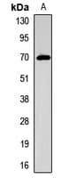 Polyclonal Rabbit anti-Human SLC5A5 / NIS Antibody (WB)