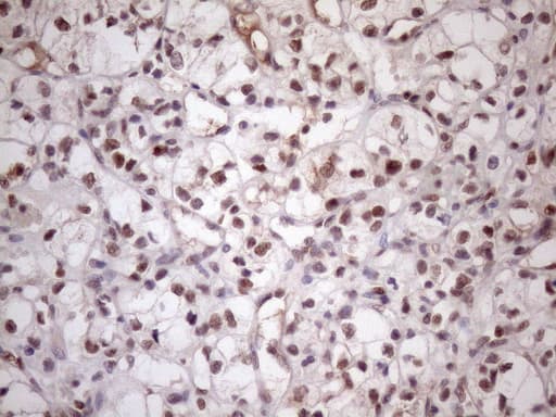 MED15 / ARC105 Antibody (aa393-679, clone OTI3F1)