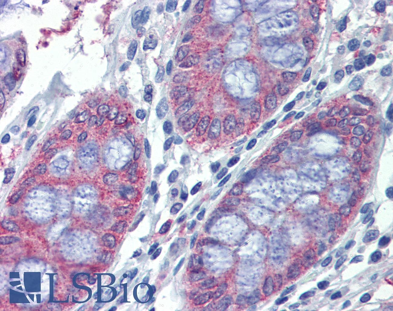 IHC-plus™ METTL7B Antibody