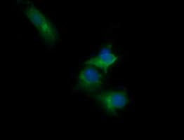 RARRES1 Antibody (clone OTI1H2)