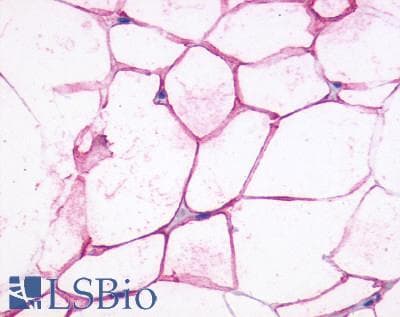 PathPlus™ ADRB3 Antibody (C-Terminus)