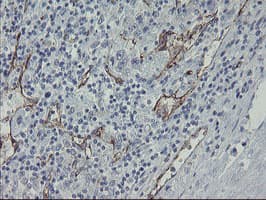 PECAM-1 / CD31 Antibody (clone OTI3H3)