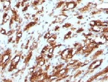 Muscle Actin Antibody (clone PMAC1-1, Ready-to-Use)