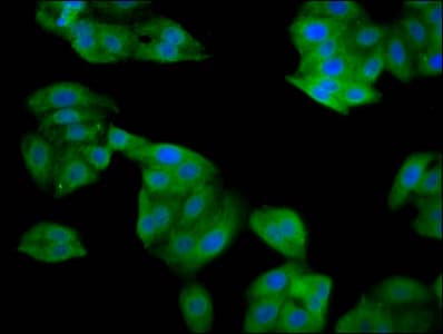 Polyclonal Rabbit anti-Human SRP14 Antibody (IF)