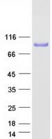 Human IKBKB / IKK2 / IKK Beta Protein (Recombinant Myc-DDK (Flag))